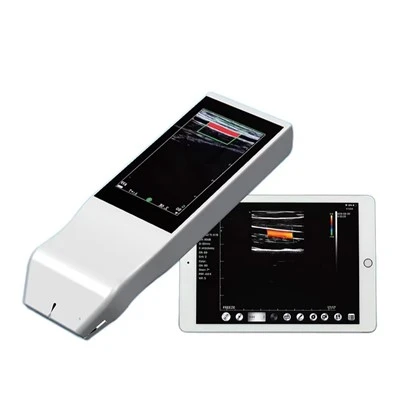 Macchina per ultrasuoni wireless portatile FTL-V5L